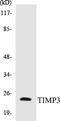 TIMP Metallopeptidase Inhibitor 3 antibody, EKC1565, Boster Biological Technology, Western Blot image 