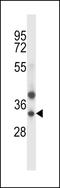 Tripartite Motif Containing 34 antibody, LS-C160190, Lifespan Biosciences, Western Blot image 