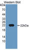 Cancer/Testis Antigen 1B antibody, abx128209, Abbexa, Western Blot image 