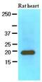 Myosin Light Chain 2 antibody, ab89594, Abcam, Western Blot image 