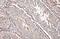 Androgen Receptor antibody, GTX135345, GeneTex, Immunohistochemistry paraffin image 