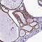 Ring Finger Protein 126 antibody, PA5-60215, Invitrogen Antibodies, Immunohistochemistry paraffin image 