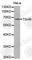 Thyroid Stimulating Hormone Receptor antibody, A1012, ABclonal Technology, Western Blot image 