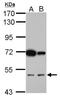CUGBP Elav-Like Family Member 2 antibody, NBP2-16034, Novus Biologicals, Western Blot image 