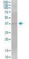 Mitochondrial RRNA Methyltransferase 1 antibody, H00079922-B01P, Novus Biologicals, Western Blot image 