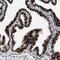 Progesterone Receptor antibody, HPA017176, Atlas Antibodies, Immunohistochemistry paraffin image 