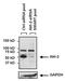 AKT Serine/Threonine Kinase 2 antibody, MA1-034, Invitrogen Antibodies, Western Blot image 