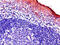 Baculoviral IAP Repeat Containing 3 antibody, CSB-PA623808LA01HU, Cusabio, Immunohistochemistry paraffin image 