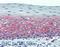 CD82 Molecule antibody, M02300-1, Boster Biological Technology, Immunohistochemistry paraffin image 