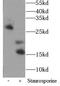 Sca1 antibody, FNab09938, FineTest, Western Blot image 