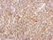 Mitogen-Activated Protein Kinase Kinase 1 antibody, GTX111338, GeneTex, Immunohistochemistry paraffin image 