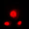 Ataxin 1 antibody, LS-C358916, Lifespan Biosciences, Immunofluorescence image 