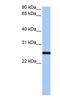 Centrosomal Protein 112 antibody, NBP1-79545, Novus Biologicals, Western Blot image 