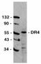 TNF Receptor Superfamily Member 10a antibody, LS-C267, Lifespan Biosciences, Western Blot image 