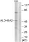 Aldehyde Dehydrogenase 1 Family Member A2 antibody, abx014815, Abbexa, Western Blot image 