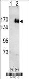 ERBB2 antibody, TA324959, Origene, Western Blot image 
