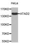ATPase Family AAA Domain Containing 2 antibody, STJ110680, St John