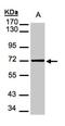 Mesothelin antibody, NBP1-31445, Novus Biologicals, Western Blot image 