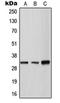 Tryptase Gamma 1 antibody, orb215104, Biorbyt, Western Blot image 