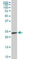 Serine And Arginine Rich Splicing Factor 3 antibody, H00006428-M08, Novus Biologicals, Western Blot image 