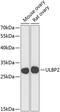 UL16 Binding Protein 2 antibody, GTX32953, GeneTex, Western Blot image 