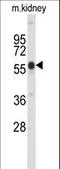 Serine/threonine-protein kinase PINK1, mitochondrial antibody, LS-C163368, Lifespan Biosciences, Western Blot image 