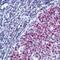MutS Homolog 2 antibody, MBS395138, MyBioSource, Immunohistochemistry paraffin image 