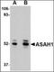 N-Acylsphingosine Amidohydrolase 1 antibody, orb88695, Biorbyt, Western Blot image 