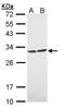 Tyrosine 3-Monooxygenase/Tryptophan 5-Monooxygenase Activation Protein Theta antibody, PA5-29421, Invitrogen Antibodies, Western Blot image 