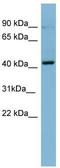 Protein kinase C beta type antibody, TA342147, Origene, Western Blot image 
