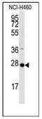 Phospholipid Phosphatase 2 antibody, AP12449PU-N, Origene, Western Blot image 