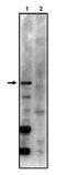 Protein Phosphatase 2 Regulatory Subunit Bgamma antibody, orb108631, Biorbyt, Western Blot image 