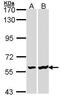 LCK Proto-Oncogene, Src Family Tyrosine Kinase antibody, GTX107785, GeneTex, Western Blot image 