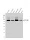Carnitine Palmitoyltransferase 1B antibody, PB9491, Boster Biological Technology, Western Blot image 