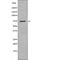 LIM Domain Kinase 1 antibody, abx216571, Abbexa, Western Blot image 