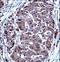 Thymidylate Synthetase antibody, LS-C203764, Lifespan Biosciences, Immunohistochemistry frozen image 