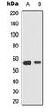 Lectin, Mannose Binding 1 antibody, orb411772, Biorbyt, Western Blot image 