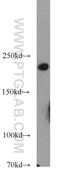 Myosin Heavy Chain 9 antibody, 14844-1-AP, Proteintech Group, Western Blot image 