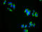 Bone Morphogenetic Protein Receptor Type 1A antibody, LS-C369335, Lifespan Biosciences, Immunofluorescence image 