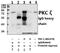 Protein Kinase C Zeta antibody, GTX66637, GeneTex, Immunoprecipitation image 