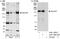 Gem Nuclear Organelle Associated Protein 5 antibody, A301-325A, Bethyl Labs, Western Blot image 