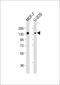 Family With Sequence Similarity 120A antibody, M09208, Boster Biological Technology, Western Blot image 