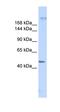 Myoferlin antibody, orb325305, Biorbyt, Western Blot image 