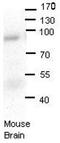 hOSC antibody, TA346238, Origene, Western Blot image 