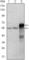 ETS Proto-Oncogene 1, Transcription Factor antibody, abx015851, Abbexa, Western Blot image 