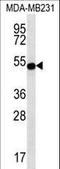 Signal Transducing Adaptor Family Member 2 antibody, LS-C161541, Lifespan Biosciences, Western Blot image 