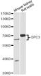 Glypican 3 antibody, A13988, ABclonal Technology, Western Blot image 