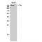 Colony Stimulating Factor 1 Receptor antibody, LS-C382689, Lifespan Biosciences, Western Blot image 