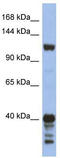 Signal-Induced Proliferation-Associated 1 antibody, TA344203, Origene, Western Blot image 