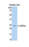 Alpha-N-Acetylgalactosaminidase antibody, LS-C300353, Lifespan Biosciences, Western Blot image 